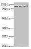 Western blot<br />
 All lanes: MERTK antibody at 10µg/ml<br />
 Lane 1: Mouse gonad tissue<br />
 Lane 2: Mouse lung tissue<br />
 Lane 3: Mouse kidney tissue<br />
 Secondary<br />
 Goat polyclonal to rabbit IgG at 1/10000 dilution<br />
 Predicted band size: 110 kDa<br />
 Observed band size: 110 kDa<br />