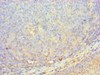 Immunohistochemistry of paraffin-embedded human tonsil tissue using CSB-PA621519ESR2HU at dilution of 1:100