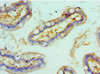 Immunohistochemistry of paraffin-embedded human small intestine tissue using CSB-PA020059ESR1HU at dilution of 1:100