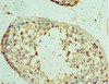 Immunohistochemistry of paraffin-embedded human testis tissue using CSB-PA025752ESR2HU at dilution of 1:100