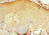 Immunohistochemistry of paraffin-embedded human skin tissue using CSB-PA004889ESR1HU at dilution of 1:100