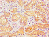 Immunohistochemistry of paraffin-embedded human kidney tissue using CSB-PA001257ESR2HU at dilution of 1:100