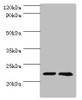 Western blot<br />
 All lanes: ASF1A antibody at 2µg/ml<br />
 Lane 1: Jurkat whole cell lysate<br />
 Lane 2: A431 whole cell lysate<br />
 Secondary<br />
 Goat polyclonal to rabbit IgG at 1/10000 dilution<br />
 Predicted band size: 23 kDa<br />
 Observed band size: 23 kDa<br />