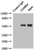 Immunoprecipitating CAMK4 in Jurkat whole cell lysate<br />
 Lane 1: Rabbit control IgG instead of (1µg) instead of CSB-PA614976ESR2HU in Jurkat whole cell lysate.
 For western blotting, a HRP-conjugated anti-rabbit IgG, specific to the non-reduced form of IgG was used as the Secondary antibody (1/50000) <br />
 Lane 2: CSB-PA614976ESR2HU (4µg) + Jurkat whole cell lysate (500µg) <br />
 Lane 3: Jurkat whole cell lysate (20µg) <br />