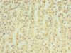 Immunohistochemistry of paraffin-embedded human adrenal gland tissue using CSB-PA013522ESR2HU at dilution of 1:100