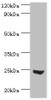 Western blot<br />
 All lanes: Mitotic spindle assembly checkpoint protein MAD2A antibody at 3µg/ml + 293T whole cell lysate<br />
 Secondary<br />
 Goat polyclonal to rabbit IgG at 1/10000 dilution<br />
 Predicted band size: 24, 11 kDa<br />
 Observed band size: 24 kDa<br />