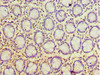 Immunohistochemistry of paraffin-embedded human colon tissue using CSB-PA018375DSR2HU at dilution of 1:100