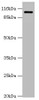 Western blot<br />
 All lanes: AP2A2 antibody at 0.61µg/ml + Mouse brain tissue<br />
 Secondary<br />
 Goat polyclonal to rabbit IgG at 1/10000 dilution<br />
 Predicted band size: 104, 105, 74 kDa<br />
 Observed band size: 104 kDa<br />