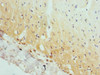 Immunohistochemistry of paraffin-embedded human heart tissue using CSB-PA001870DSR2HU at dilution of 1:100