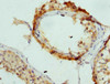 Immunohistochemistry of paraffin-embedded human testis tissue using CSB-PA001870DSR2HU at dilution of 1:100