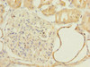 Immunohistochemistry of paraffin-embedded human kidney tissue using CSB-PA889167ESR2HU at dilution of 1:100