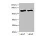 Western blot<br />
 All lanes: PPM1Dantibody at 2.36µg/ml<br />
 Lane 1: Rat gonadal tissue<br />
 Lane 2: U87 whole cell lysate<br />
 Secondary<br />
 Goat polyclonal to rabbit IgG at 1/10000 dilution<br />
 Predicted band size: 67, 48 kDa<br />
 Observed band size: 67 kDa<br />