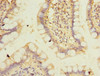 Immunohistochemistry of paraffin-embedded human small intestine tissue using CSB-PA018491ESR1HU at dilution of 1:100