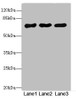 Western blot<br />
 All lanes: PPM1Dantibody at 2.66µg/ml<br />
 Lane 1: Rat gonadal tissue<br />
 Lane 2: U87 whole cell lysate<br />
 Lane 3: 293T whole cell lysate<br />
 Secondary<br />
 Goat polyclonal to rabbit IgG at 1/10000 dilution<br />
 Predicted band size: 67, 48 kDa<br />
 Observed band size: 67 kDa<br />