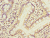 Immunohistochemistry of paraffin-embedded human small intestine tissue using CSB-PA018491ESR2HU at dilution of 1:100