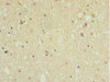 Immunohistochemistry of paraffin-embedded human brain tissue using CSB-PA619761ESR1HU at dilution of 1:100