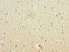 Immunohistochemistry of paraffin-embedded human brain tissue using CSB-PA860785DSR2HU at dilution of 1:100