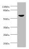 Western blot<br />
 All lanes: CDC7 antibody at 0.95µg/ml + SY-5Y whole cell lysate<br />
 Secondary<br />
 Goat polyclonal to rabbit IgG at 1/10000 dilution<br />
 Predicted band size: 64 kDa<br />
 Observed band size: 64 kDa<br />