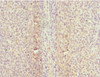 Immunohistochemistry of paraffin-embedded human tonsil tissue using CSB-PA005023ESR1HU at dilution of 1:100