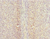 Immunohistochemistry of paraffin-embedded human tonsil tissue using CSB-PA005023ESR1HU at dilution of 1:100