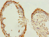 Immunohistochemistry of paraffin-embedded human testis tissue using CSB-PA005023ESR1HU at dilution of 1:100