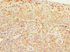 Immunohistochemistry of paraffin-embedded human tonsil tissue using CSB-PA005023ESR2HU at dilution of 1:100