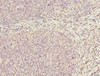Immunohistochemistry of paraffin-embedded human tonsil tissue using CSB-PA890695DSR2HU at dilution of 1:100
