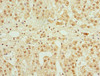 Immunohistochemistry of paraffin-embedded human adrenal gland tissue using CSB-PA005272DSR1HU at dilution of 1:100