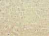 Immunohistochemistry of paraffin-embedded human liver tissue using CSB-PA013773ESR2HU at dilution of 1:100