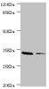 Western blot<br />
 All lanes: MGLL antibody at 2.37µg/ml<br />
 Lane 1: Mouse liver tissue<br />
 Lane 2: HT-29 whole cell lysate<br />
 Secondary<br />
 Goat polyclonal to rabbit IgG at 1/10000 dilution<br />
 Predicted band size: 34, 32 kDa<br />
 Observed band size: 34 kDa<br />