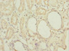 Immunohistochemistry of paraffin-embedded human kidney tissue using CSB-PA013787ESR1HU at dilution of 1:100