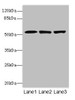 Western blot<br />
 All lanes: CPSF3Lantibody at 4.2µg/ml<br />
 Lane 1: Colo320 whole cell lysate<br />
 Lane 2: Hela whole cell lysate<br />
 Lane 3: MCF-7 whole cell lysate<br />
 Secondary<br />
 Goat polyclonal to rabbit IgG at 1/10000 dilution<br />
 Predicted band size: 68, 57, 66, 65, 69 kDa<br />
 Observed band size: 68 kDa<br />
