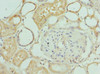 Immunohistochemistry of paraffin-embedded human kidney tissue using CSB-PA011758ESR1HU at dilution of 1:100 Immunohistochemistry of paraffin-embedded human kidney tissue using CSB-PA011758ESR1HU at dilution of 1:100