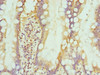 Immunohistochemistry of paraffin-embedded human small intestine tissue using CSB-PA011758ESR1HU at dilution of 1:100 Immunohistochemistry of paraffin-embedded human small intestine tissue using CSB-PA011758ESR1HU at dilution of 1:100