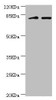 Western blot<br />
 All lanes: KIF2B antibody at 3.59µg/ml<br />
 Lane 1: Mouse lung tissue<br />
 Lane 2: 293T whole cell lysate<br />
 Secondary<br />
 Goat polyclonal to rabbit IgG at 1/10000 dilution<br />
 Predicted band size: 76 kDa<br />
 Observed band size: 80, 150 kDa<br />