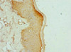 Immunohistochemistry of paraffin-embedded human skin tissue using CSB-PA839797DSR2HU at dilution of 1:100