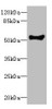Western blot<br />
 All lanes: COCH antibody at 1.73µg/ml + Human placenta tissue<br />
 Secondary<br />
 Goat polyclonal to rabbit IgG at 1/10000 dilution<br />
 Predicted band size: 60, 54 kDa<br />
 Observed band size: 54 kDa<br />