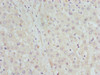Immunohistochemistry of paraffin-embedded human liver tissue using CSB-PA754361ESR1HU at dilution of 1:100
