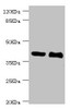 Western blot<br />
 All lanes: NHLRC1 antibody at 3.13µg/ml<br />
 Lane 1: LO2 whole cell lysate<br />
 Lane 2: Rat liver tissue<br />
 Secondary<br />
 Goat polyclonal to rabbit IgG at 1/10000 dilution<br />
 Predicted band size: 42 kDa<br />
 Observed band size: 42 kDa<br />