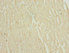 Immunohistochemistry of paraffin-embedded human heart tissue using CSB-PA740936ESR2HU at dilution of 1:100