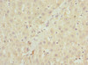 Immunohistochemistry of paraffin-embedded human liver tissue using CSB-PA740936ESR2HU at dilution of 1:100
