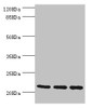 Western blot<br />
 All lanes: TAGLN2 antibody at 2.64µg/ml<br />
 Lane 1: 293T whole cell lysate<br />
 Lane 2: K562 whole cell lysate<br />
 Lane 3: MCF-7 whole cell lysate<br />
 Secondary<br />
 Goat polyclonal to rabbit IgG at 1/10000 dilution<br />
 Predicted band size: 23, 25 kDa<br />
 Observed band size: 23 kDa<br />