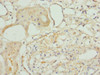 Immunohistochemistry of paraffin-embedded human kidney tissue using CSB-PA023106DSR2HU at dilution of 1:100