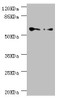 Western blot<br />
 All lanes: CCT5 antibody at 1.78µg/ml<br />
 Lane 1: Hela whole cell lysate<br />
 Lane 2: Colo320 whole cell lysate<br />
 Secondary<br />
 Goat polyclonal to rabbit IgG at 1/10000 dilution<br />
 Predicted band size: 60, 50 kDa<br />
 Observed band size: 60 kDa<br />