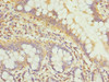 Immunohistochemistry of paraffin-embedded human small intestine tissue using CSB-PA613501ESR1HU at dilution of 1:100