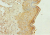 Immunohistochemistry of paraffin-embedded human skin tissue using CSB-PA613501ESR1HU at dilution of 1:100