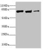 Western blot<br />
 All lanes: KIF3A antibody at 9.45µg/ml<br />
 Lane 1: MCF-7 whole cell lysate<br />
 Lane 2: Rat gonad tissue<br />
 Lane 3: 293T whole cell lysate<br />
 Secondary<br />
 Goat polyclonal to rabbit IgG at 1/10000 dilution<br />
 Predicted band size: 80 kDa<br />
 Observed band size: 80 kDa<br />