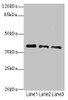 Western blot<br />
 All lanes: RP2antibody at 3.81µg/ml<br />
 Lane 1: Jurkat whole cell lysate<br />
 Lane 2: HepG2 whole cell lysate<br />
 Lane 3: Hela whole cell lysate<br />
 Secondary<br />
 Goat polyclonal to rabbit IgG at 1/10000 dilution<br />
 Predicted band size: 40 kDa<br />
 Observed band size: 40 kDa<br />
