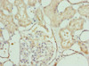 Immunohistochemistry of paraffin-embedded human kidney tissue using CSB-PA719414ESR1HU at dilution of 1:100