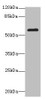 Western blot<br />
 All lanes: MMP19antibody at 2.58µg/ml + Mouse lung tissue<br />
 Secondary<br />
 Goat polyclonal to rabbit IgG at 1/10000 dilution<br />
 Predicted band size: 58, 26, 7, 34 kDa<br />
 Observed band size: 58 kDa<br />